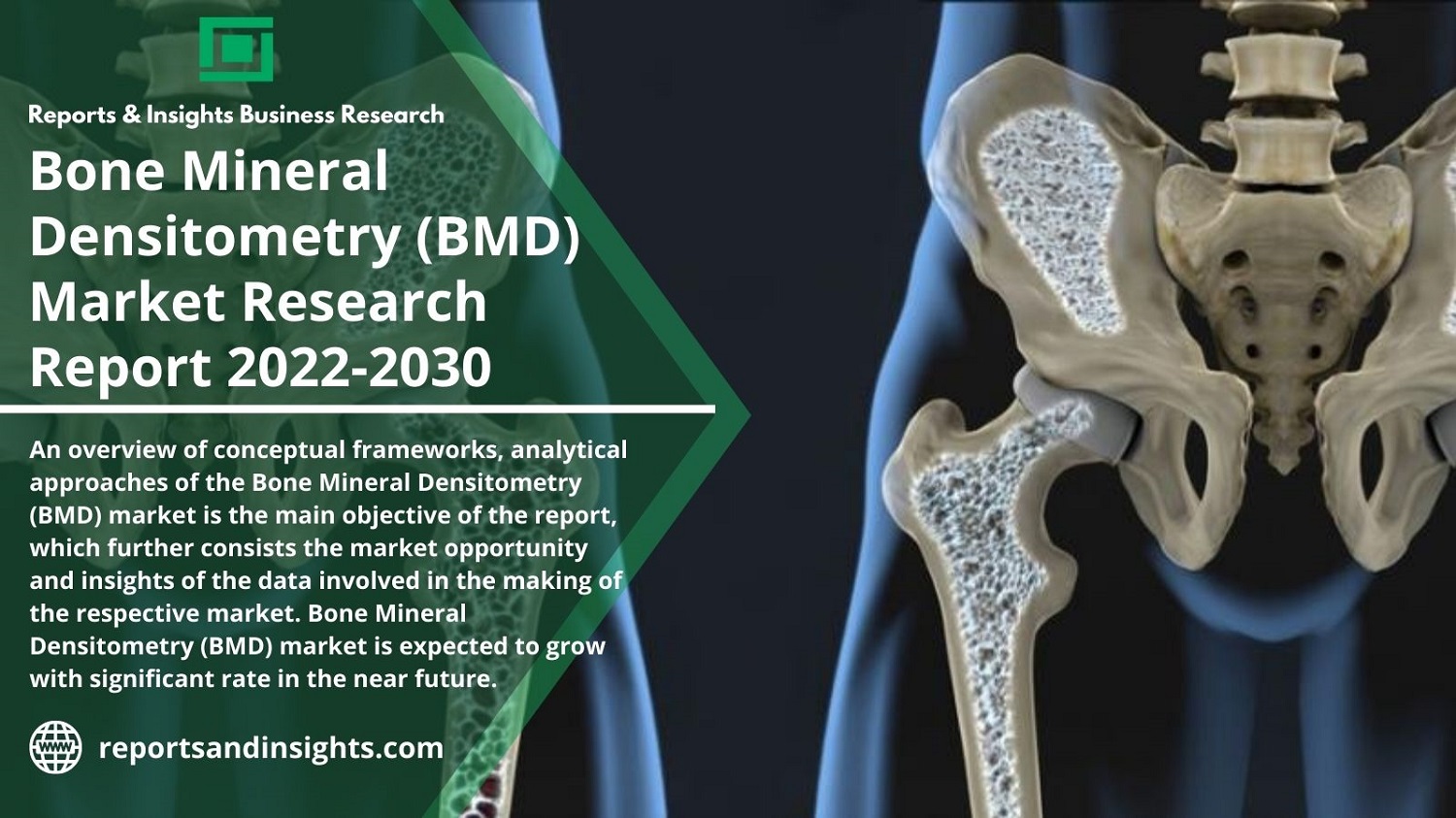 Insights on Bone Mineral Densitometry (BMD) Market Size, Shares, Key Players, by the end of Forecast Period of 2022 – 2030 by Reports and Insights